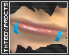 [t.B]Blew SnakeBites.