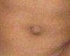 Navel 2